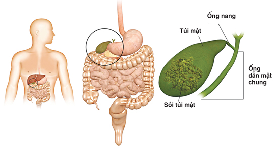 Bệnh đường mật