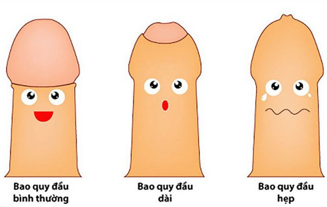 Hẹp bao qui đầu