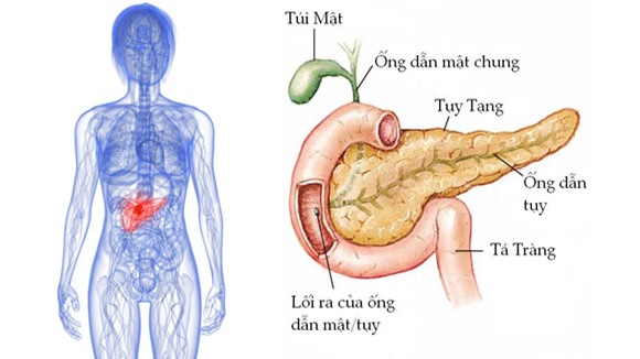 Ung thư tuyến tụy