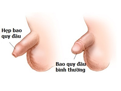 bao quy đầu