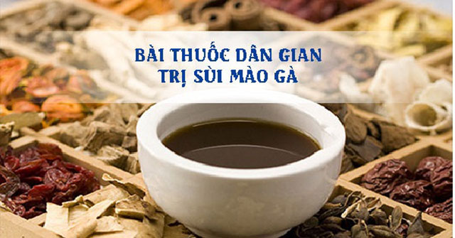 Bài thuốc hỗ trợ trị bệnh sùi mào gà