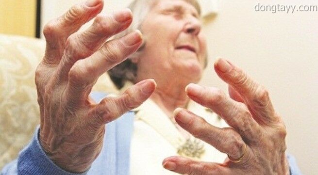 Thoái hóa khớp bàn tay ở người cao tuổi