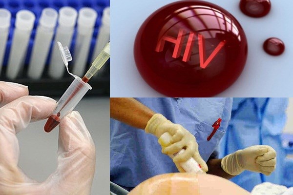 Máu HIV dính vết thương hở có lây?
