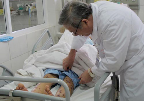Hà Nội đã có ca nhiễm não mô cầu đầu tiên nhập viện